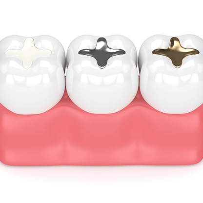 Teeth Filling in RS Puram Coimbatore