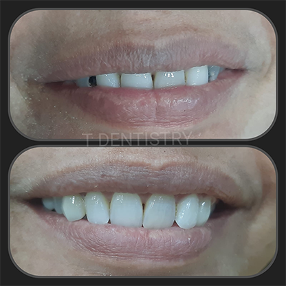 Dental Clinic in RS Puram,Coimbatore