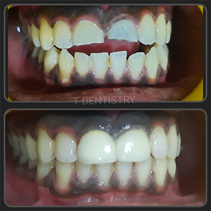 Dentist in RS Puram,Coimbatore