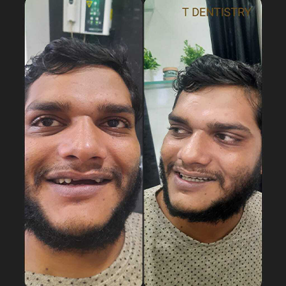 Dentist in RS Puram,Coimbatore